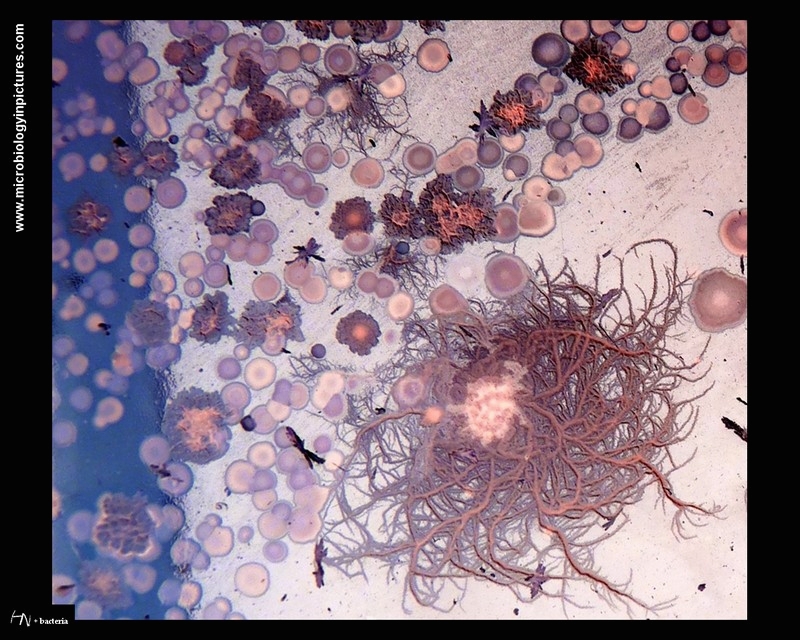 bacteria